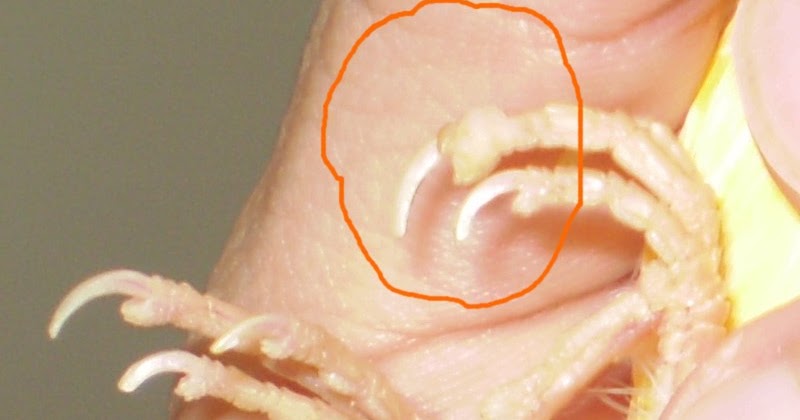 Do que tratar um prego em uma perna em uma mancha preta